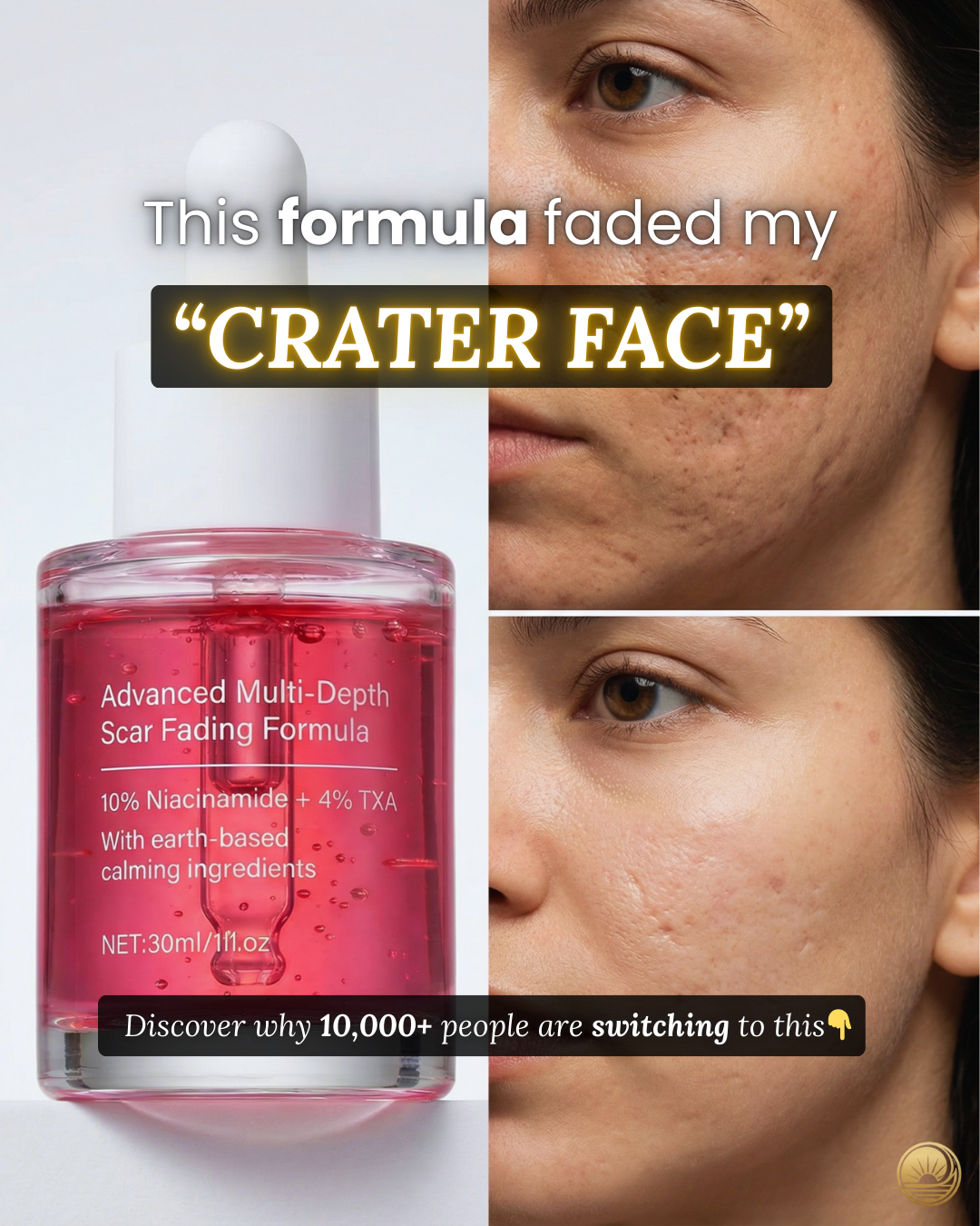 Terraura Facebook ad: From Crater to Confident in 12 Weeks