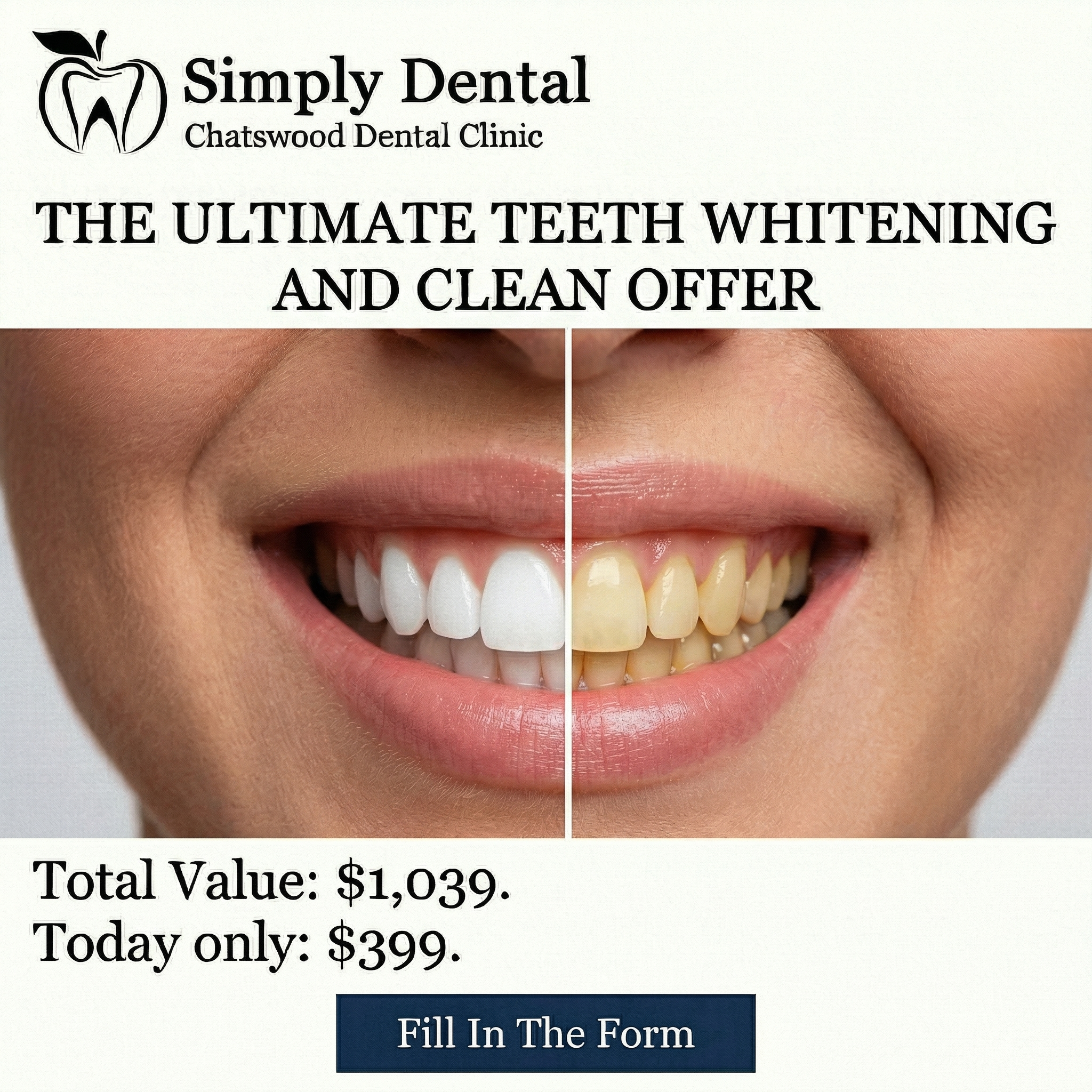 Simply Dental Chatswood Facebook ad: Get a Whiter Smile Today for Just $399!