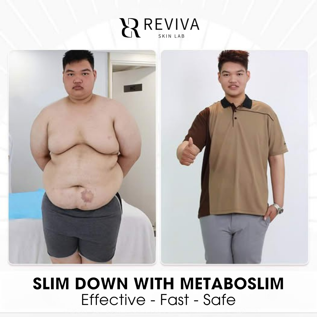 Reviva Skin Lab Aesthetics Facebook ad: ENJOY 35% OFF FOR A LIMITED TIME