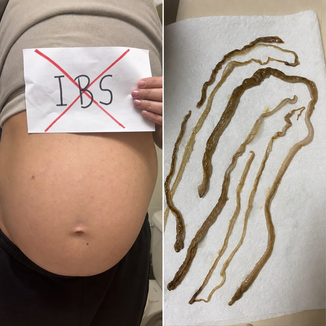 The Parasite Cleanse Community Facebook ad