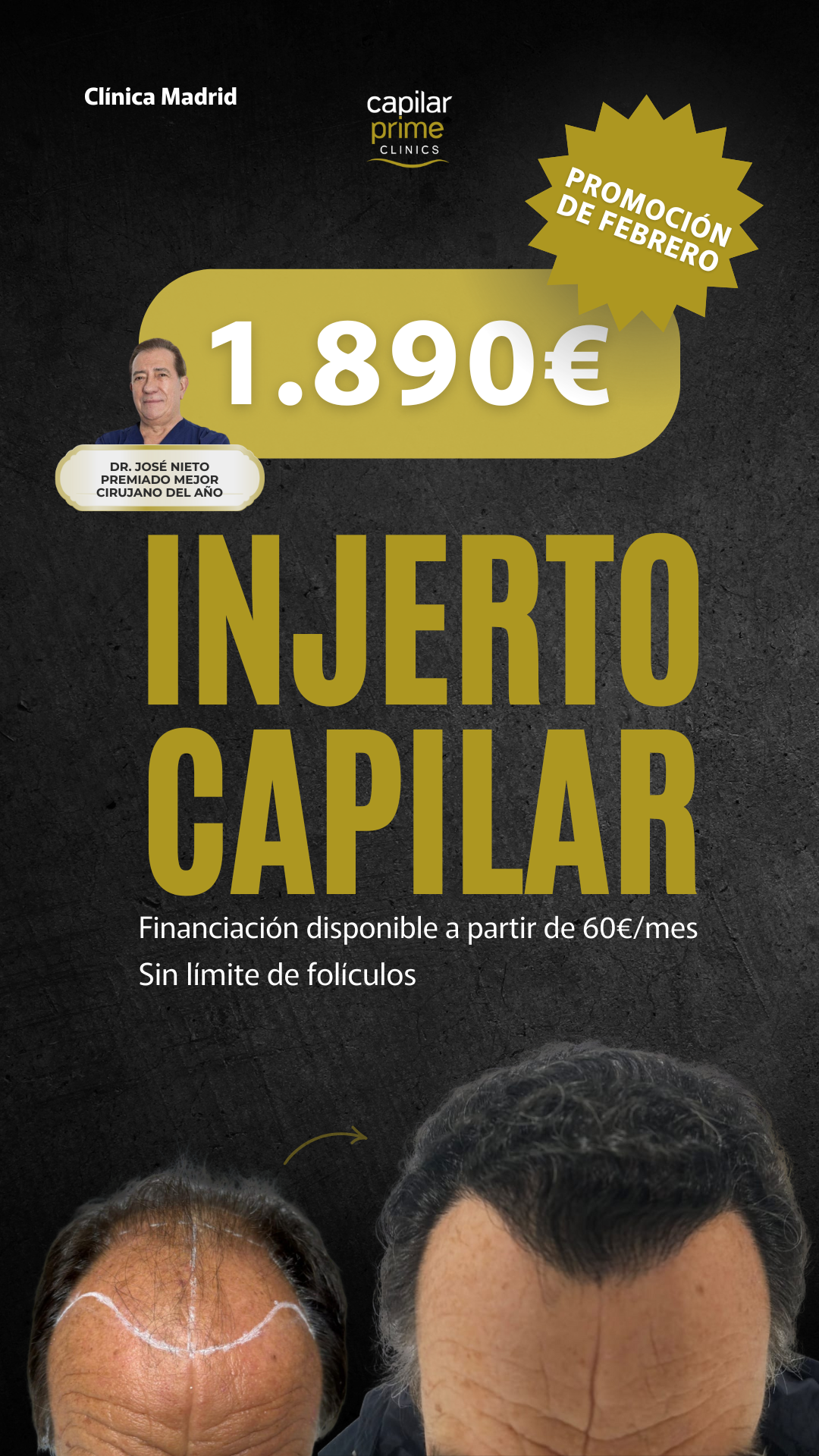 Capilar Prime Clinics Facebook ad from Feb 12, 2026
