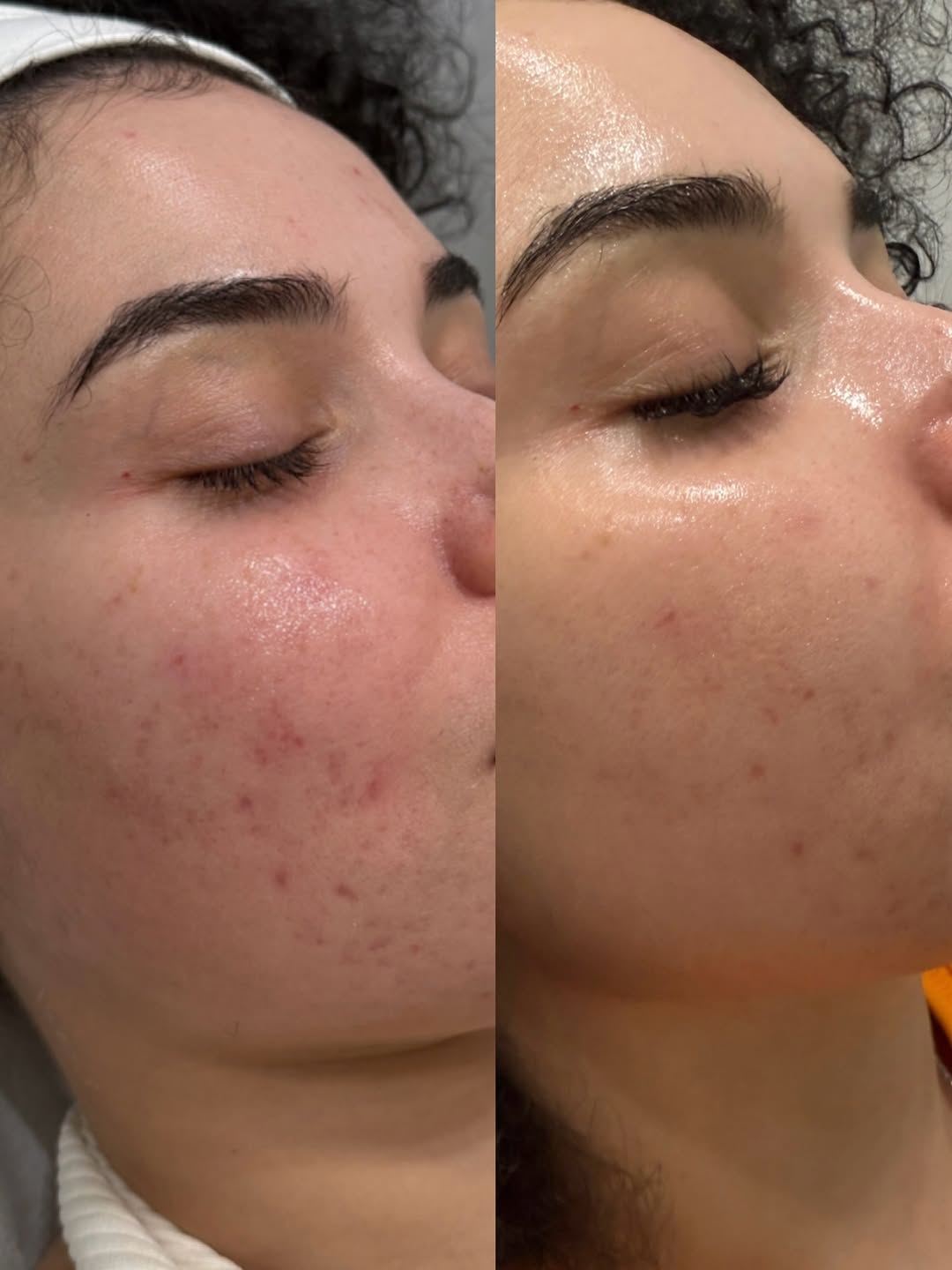 Hello Hydration Med Spa Facebook ad: Smoother Skin Starts Here
