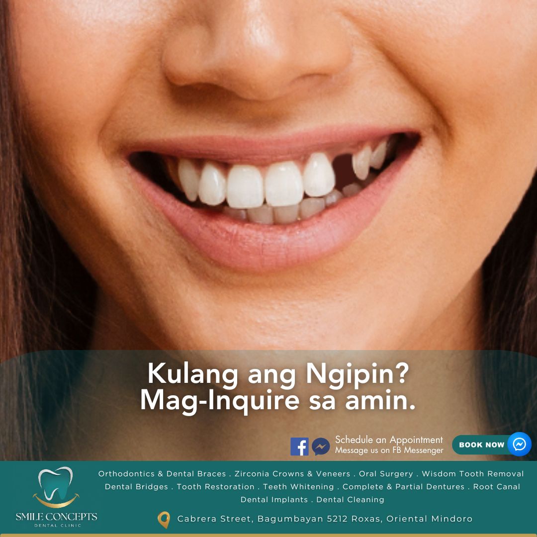 Smile Concepts Dental Clinic Facebook ad: Your Trusted Dental Clinic in Roxas, Oriental Mindoro