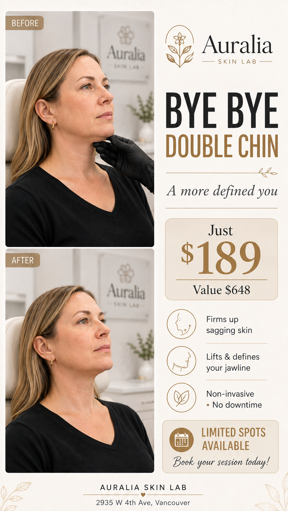 Auralia Skin Lab Facebook ad: Double chin + sagging skin? Define & tighten!, Only $189!