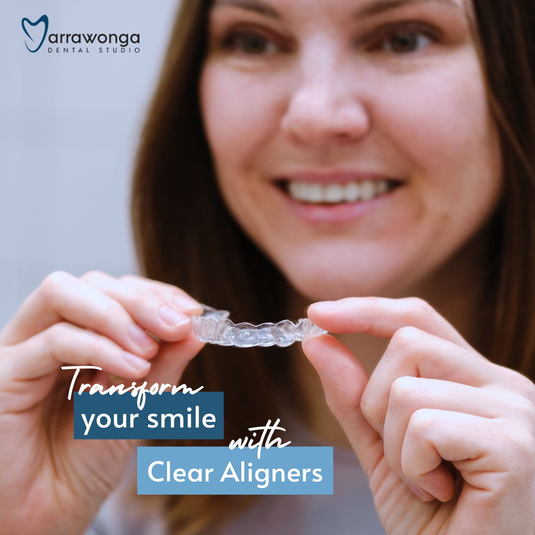 Yarrawonga Dental Studio Facebook ad