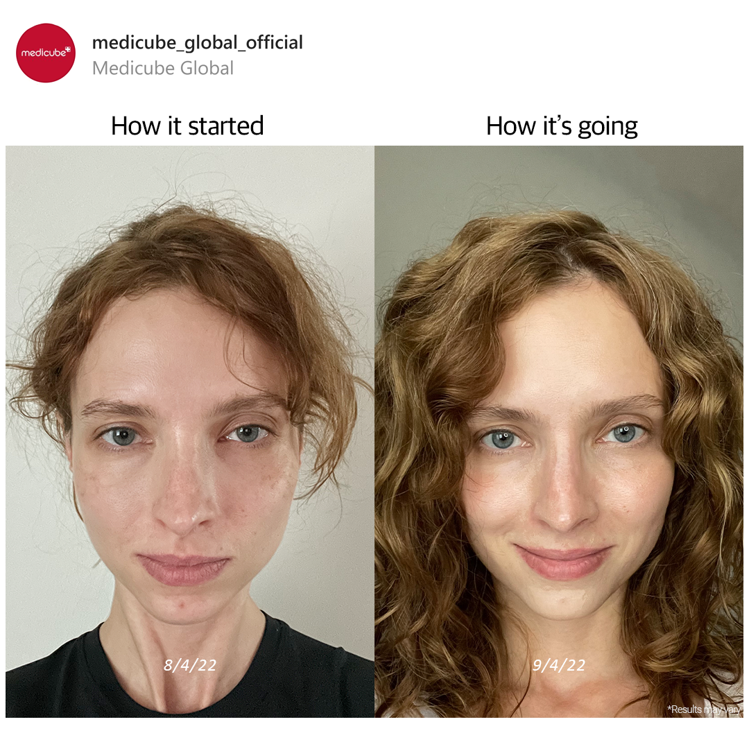 Medicube Facebook ad