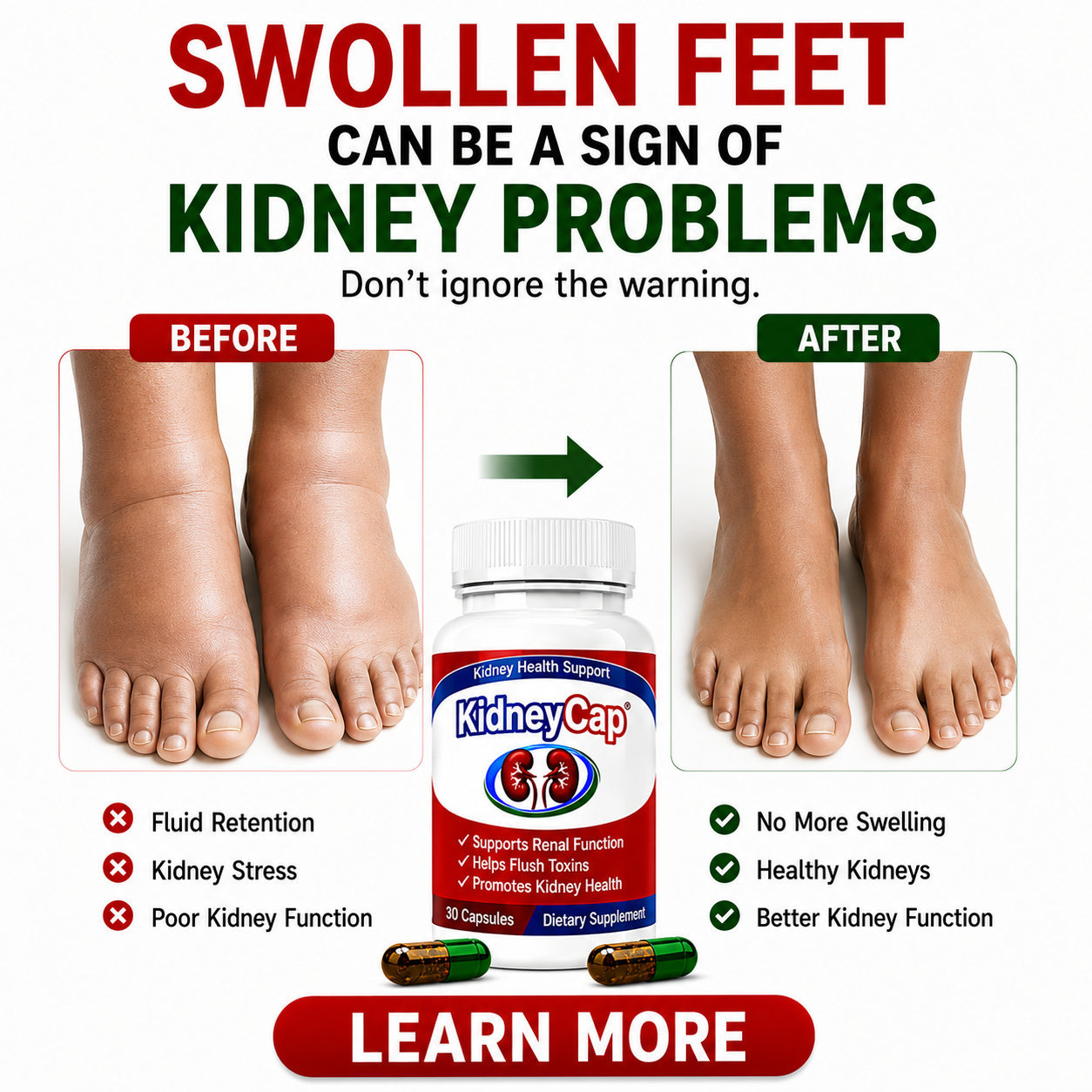 Wellness Hope Facebook ad: DON'T WAIT UNTIL YOUR KIDNEYS FORCE YOU TO PAY ATTENTION.PAY