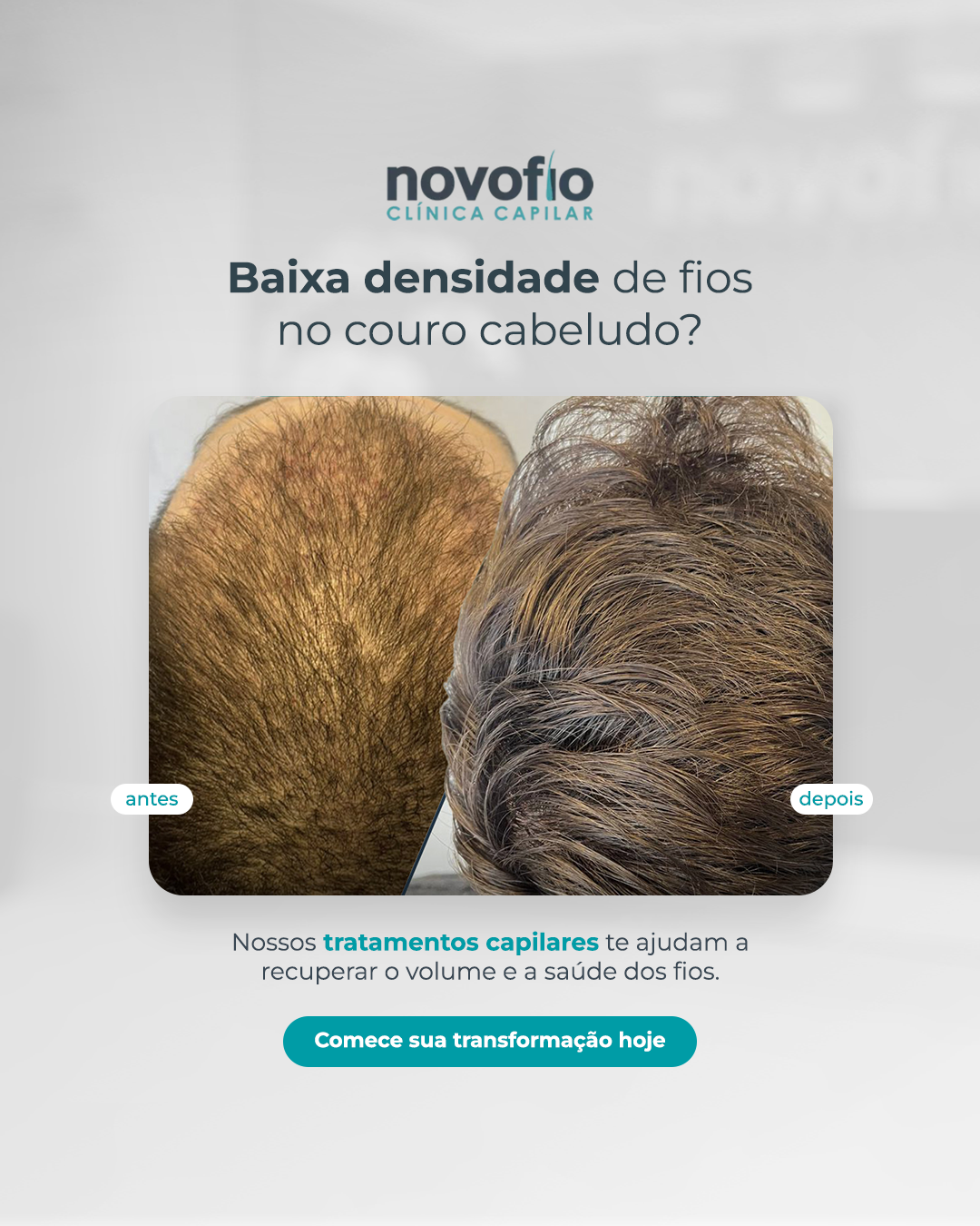 Novofio Presidente Prudente Clínica Capilar Facebook ad