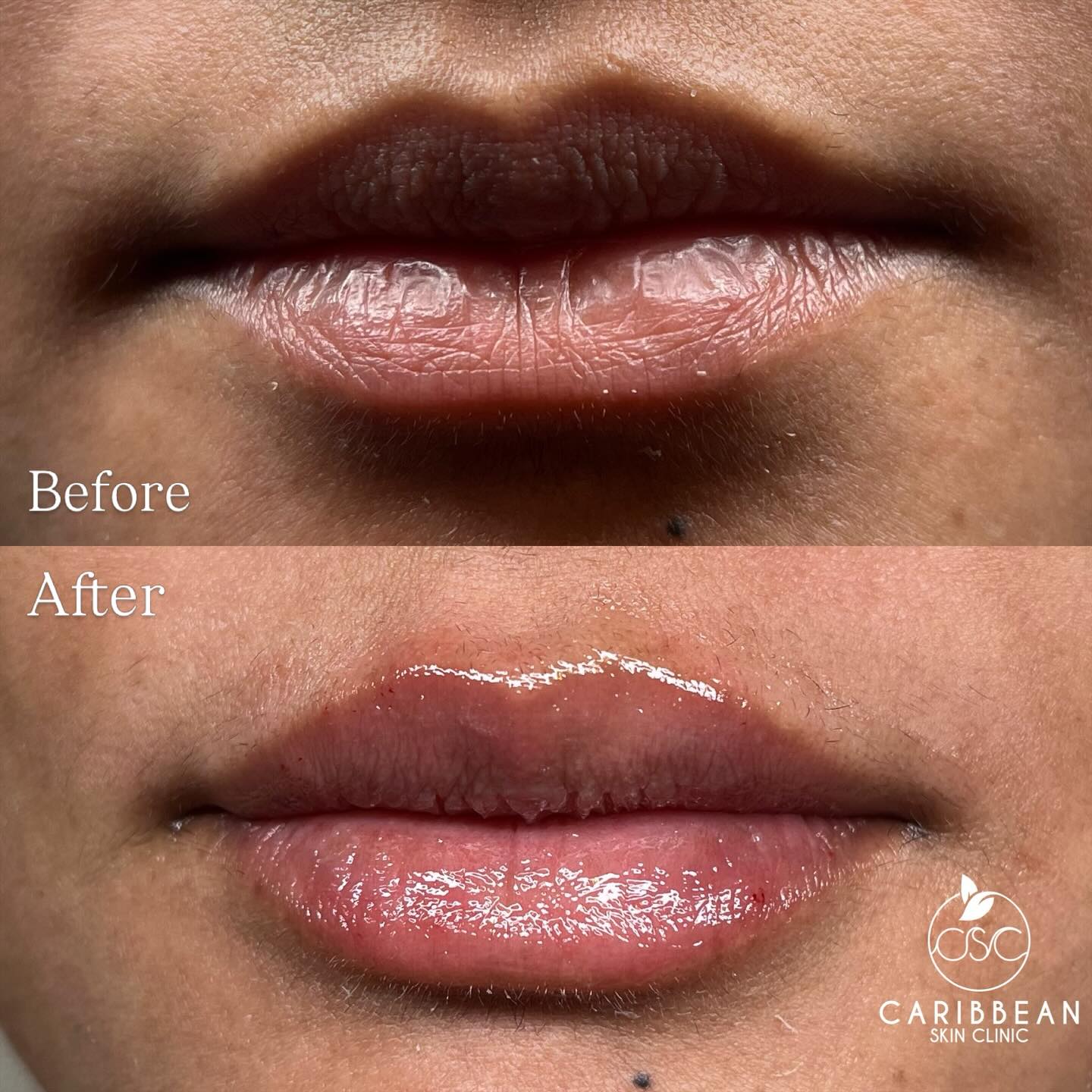 Caribbean Skin Clinic Facebook ad: Subtle but JUST enough - this is exactly…