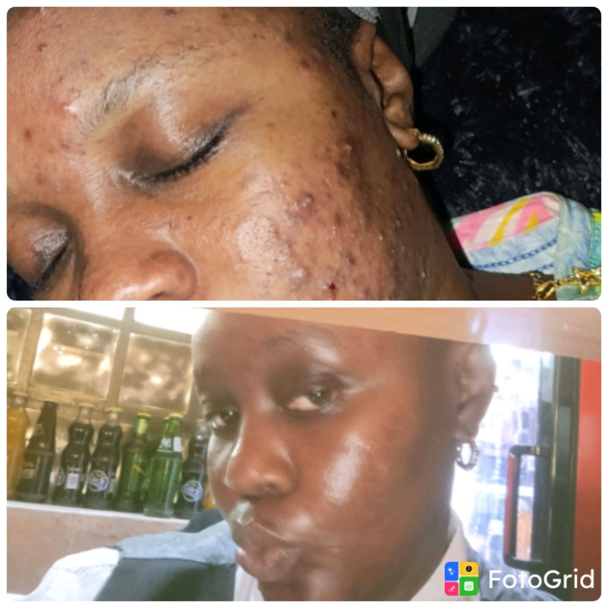 Wangeci Wa kariuki Facebook ad: at Fechi organics Today we are celebrating our…