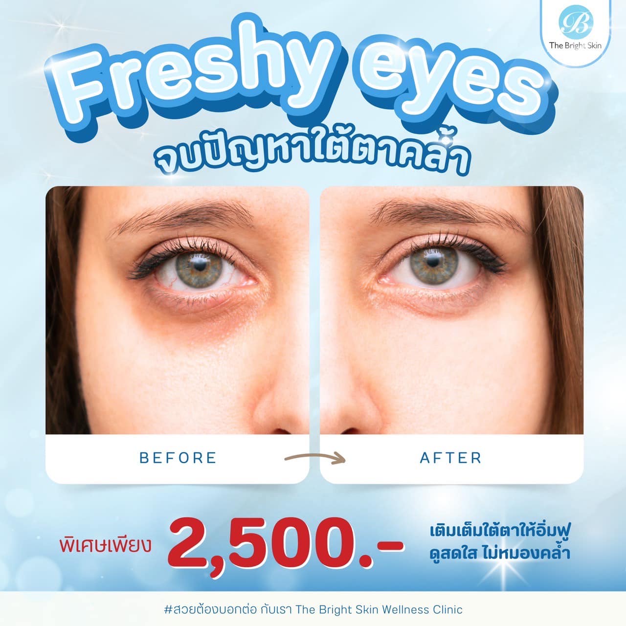 The Bright Skin Wellness Clinic พระราม 3 Facebook ad
