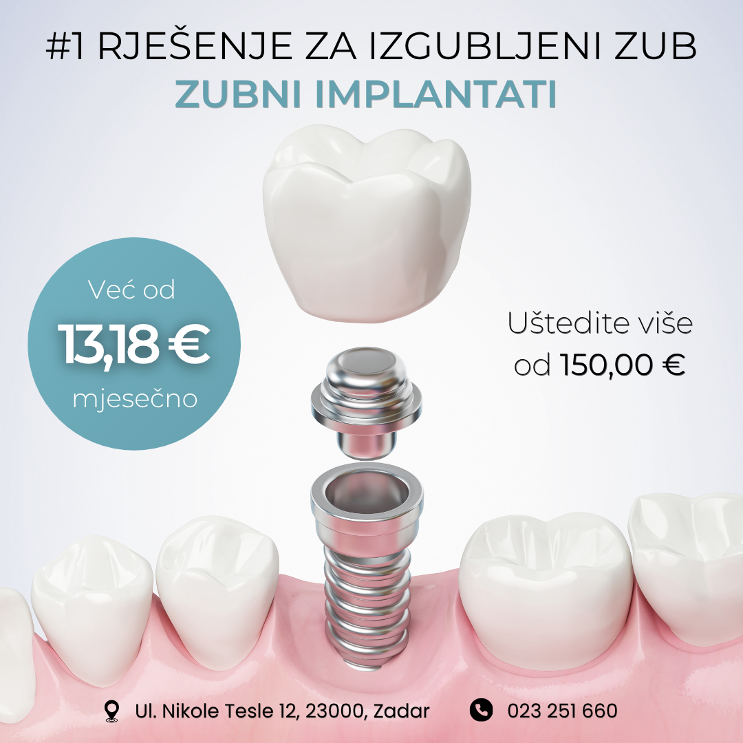 Dentex - Dentalni i implantološki centar Facebook ad: Zubni implantat - popust