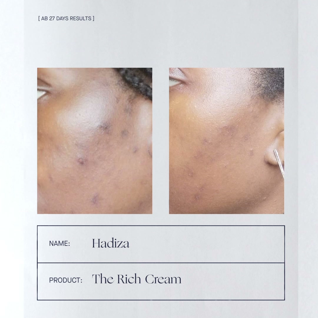 Augustinus Bader Facebook ad: A beauty phenomenon - The Rich Cream