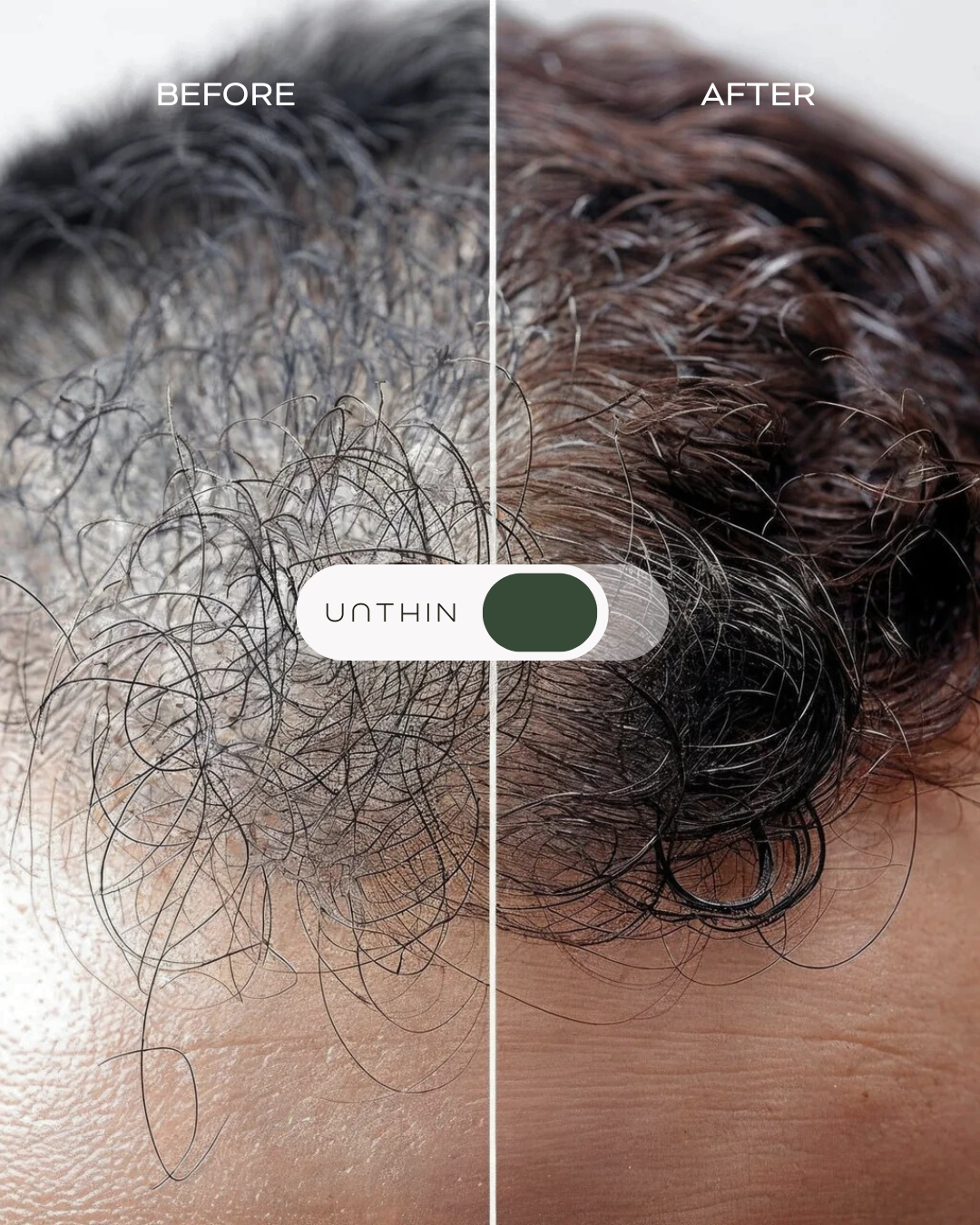 Unthin Hair - Hair Regrowth Serum Facebook ad: UNTHIN - Hair Regrowth Serum