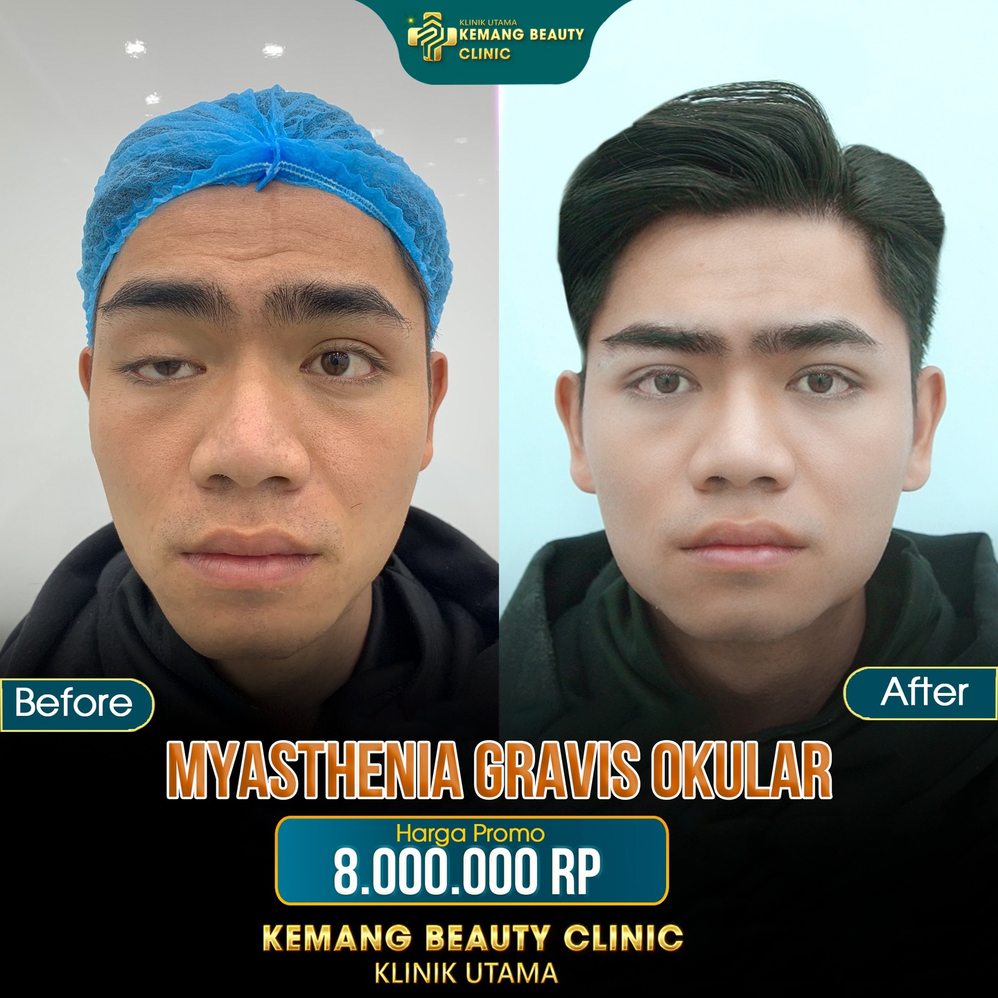 Kemang Beauty Clinic688 Facebook ad