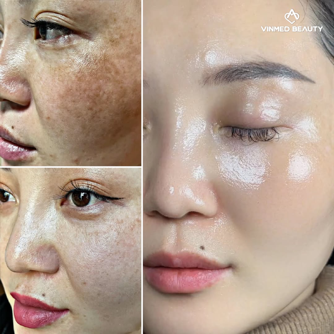 Vinmed Beauty - Luxury Aesthetic Center in Dubai Facebook ad