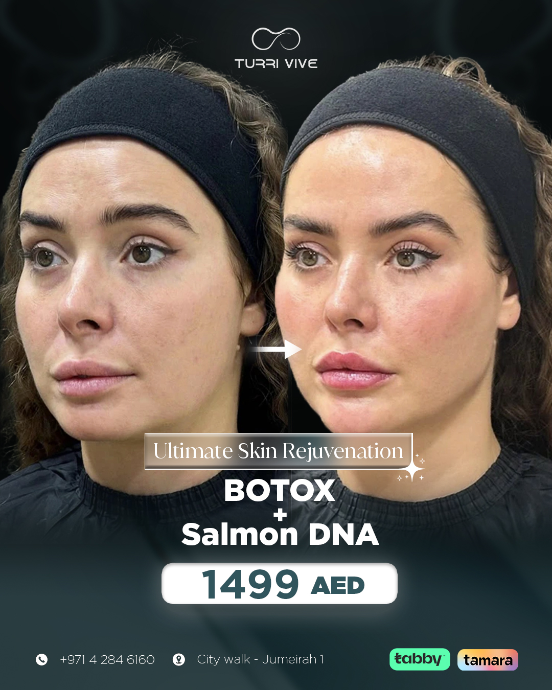 Yas & Lejou Medical - TURRI VIVE Facebook ad: Reveal smoother, firmer, radiant skin with Botox +…