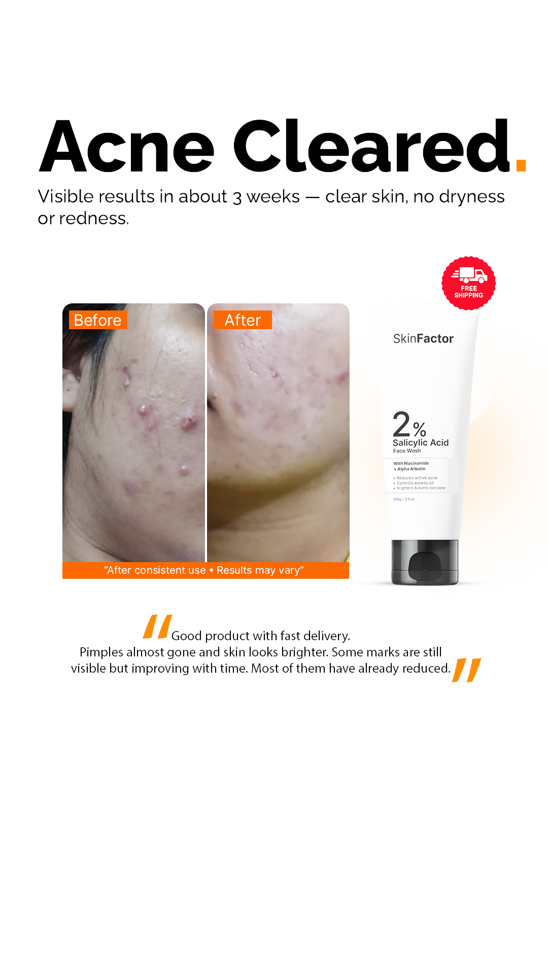 SkinFactor Facebook ad