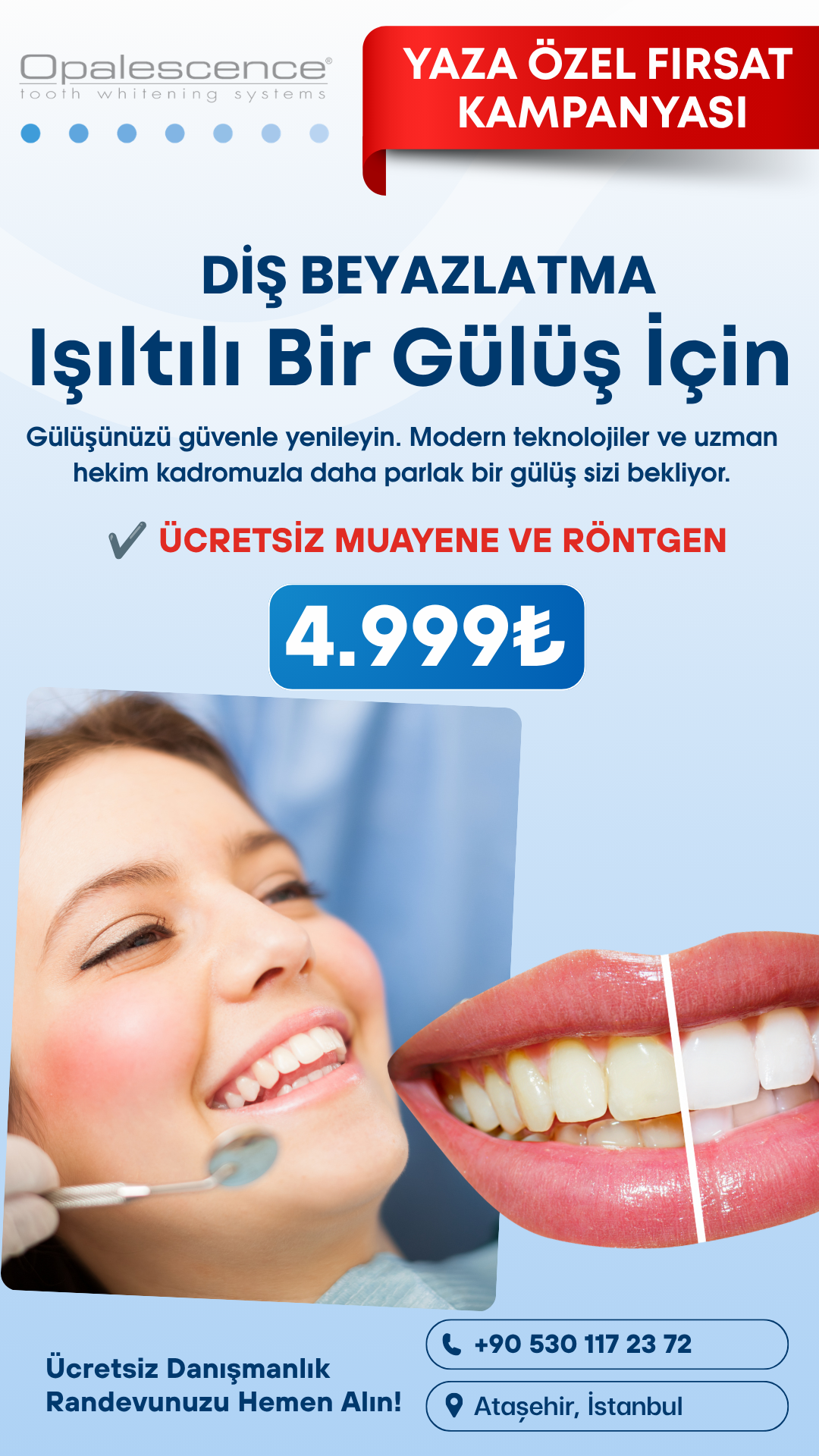 atasehirdishastanesi Facebook ad: Işıltılı Bir Gülüş İçin Hayalinizdeki Diş Beyazlatma…