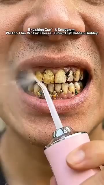 Afrique mall Facebook ad: Nettoyez Vos Dents Comme Chez le Dentiste