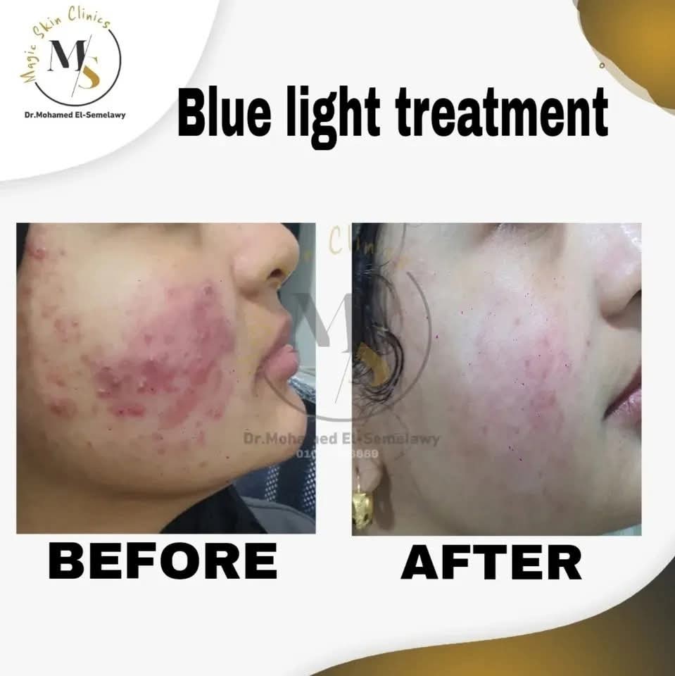 Magic skin clinics Facebook ad