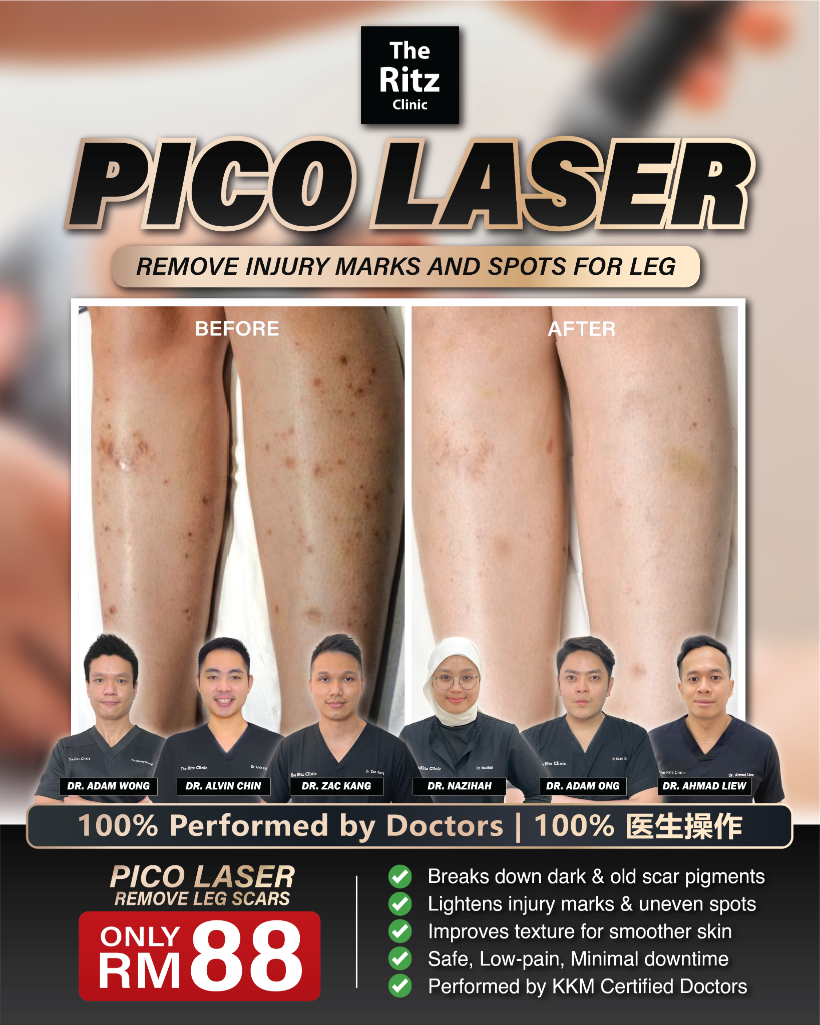 The Ritz Clinic - LCP Certified Facebook ad from Jan 12, 2026