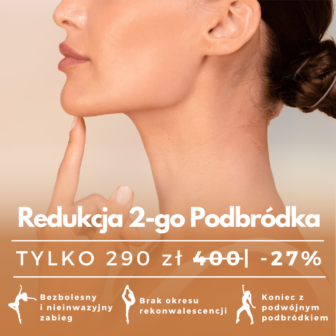 Babskie Fanaberie Facebook ad