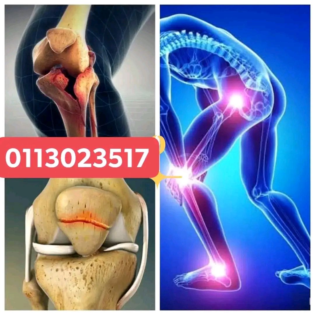 medical and Health, beauty, cosmetic & personal care, Shopping & retail. Facebook ad: JOINT PAIN • ARTHRITIS • NERVE PAIN, ADVANCED…