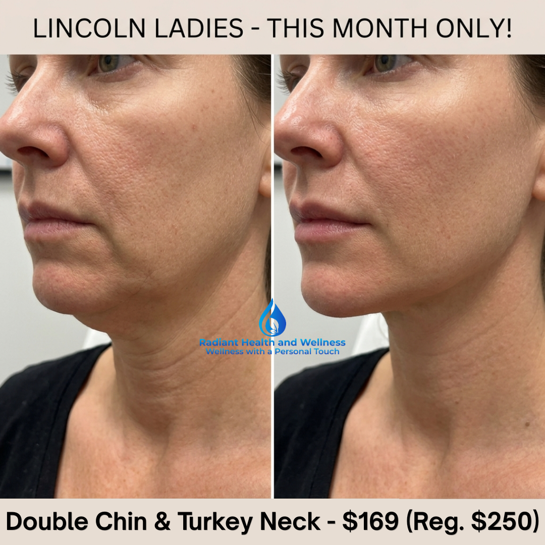 Radiant Esthetics & Wellness- Lincoln NE Facebook ad: Summer Jawline Rescue, Snatch Your Neck & Chin for $169