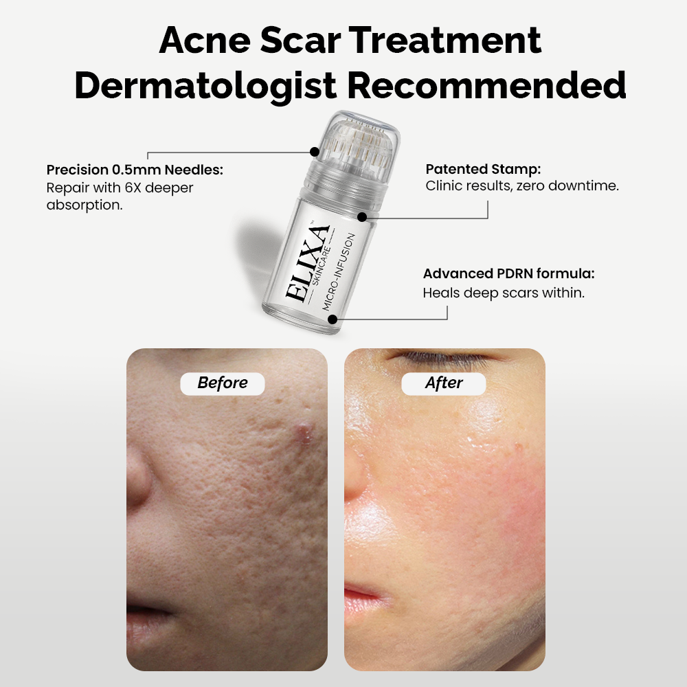 Elixa Skincare Facebook ad