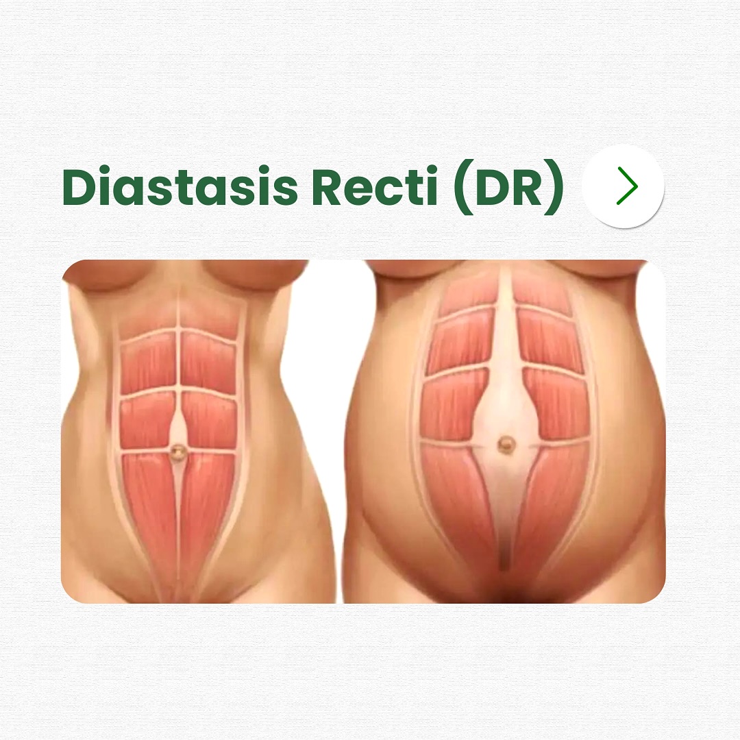 Orchard Health Clinic Facebook ad: Did you know - Up to 60% of…