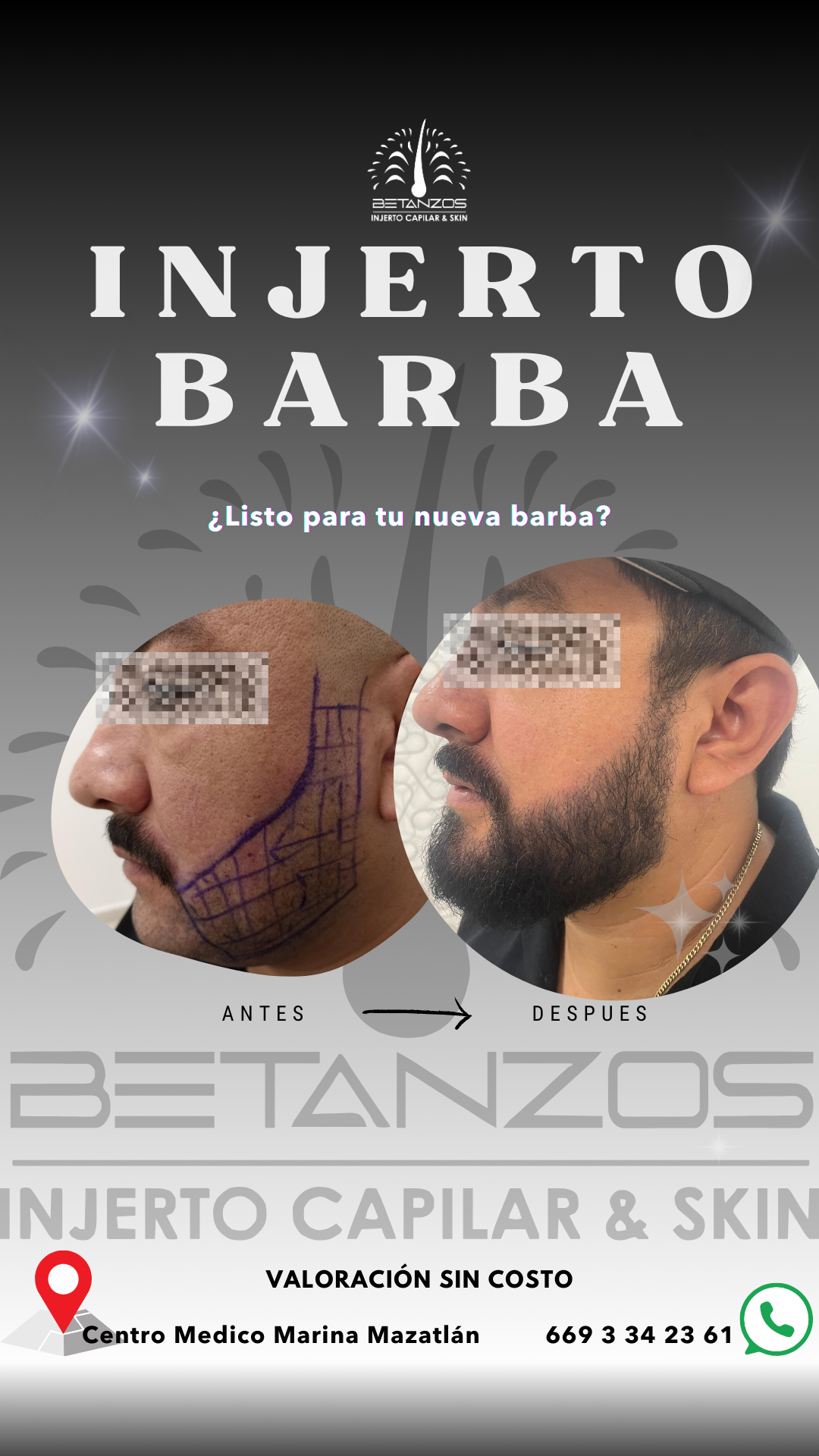 Betanzos Injerto Capilar & Skin Facebook ad from Mar 8, 2026
