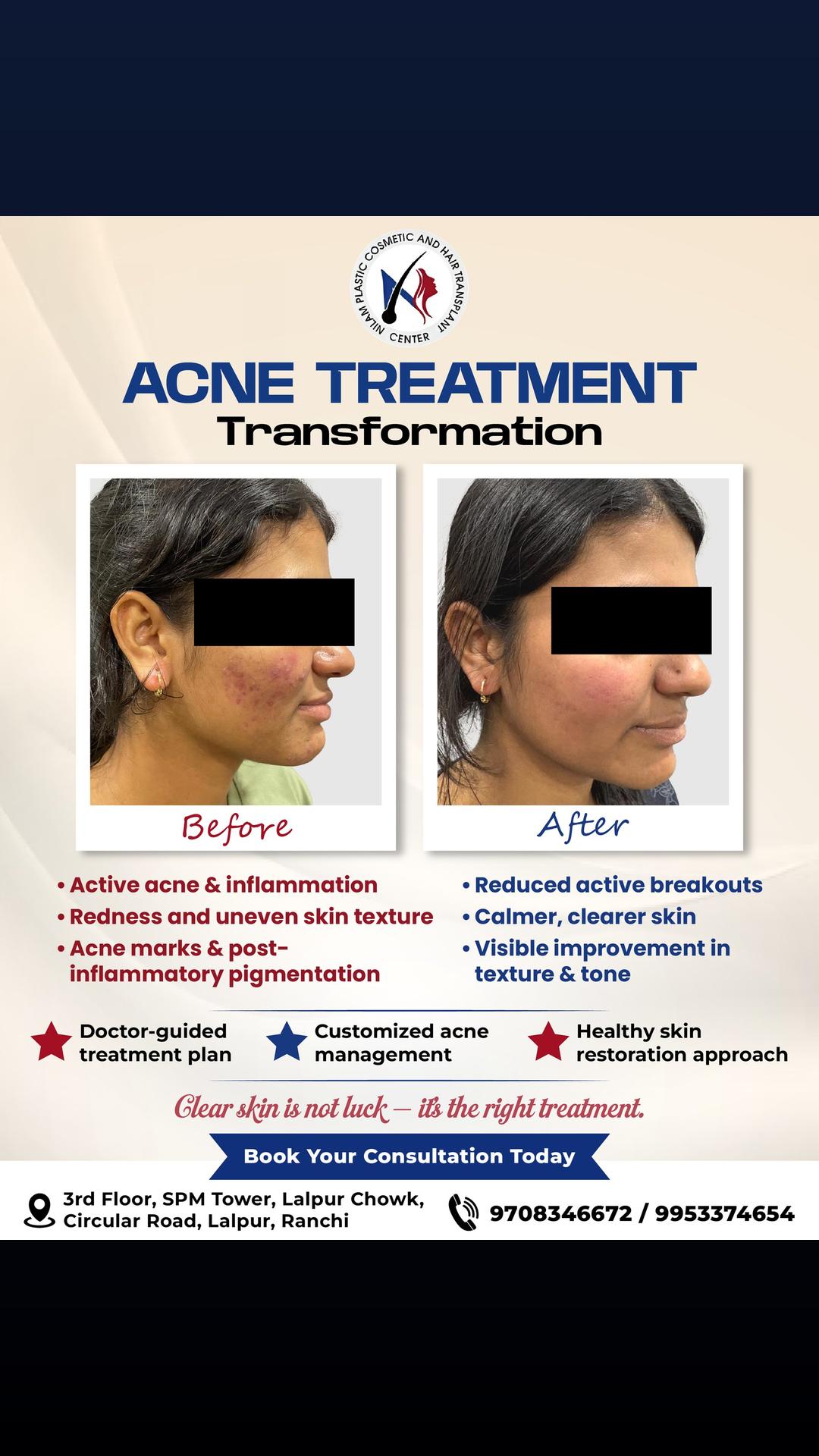 Nilam Plastic and Cosmetic Clinic Facebook ad: Message us for a FREE Consultation