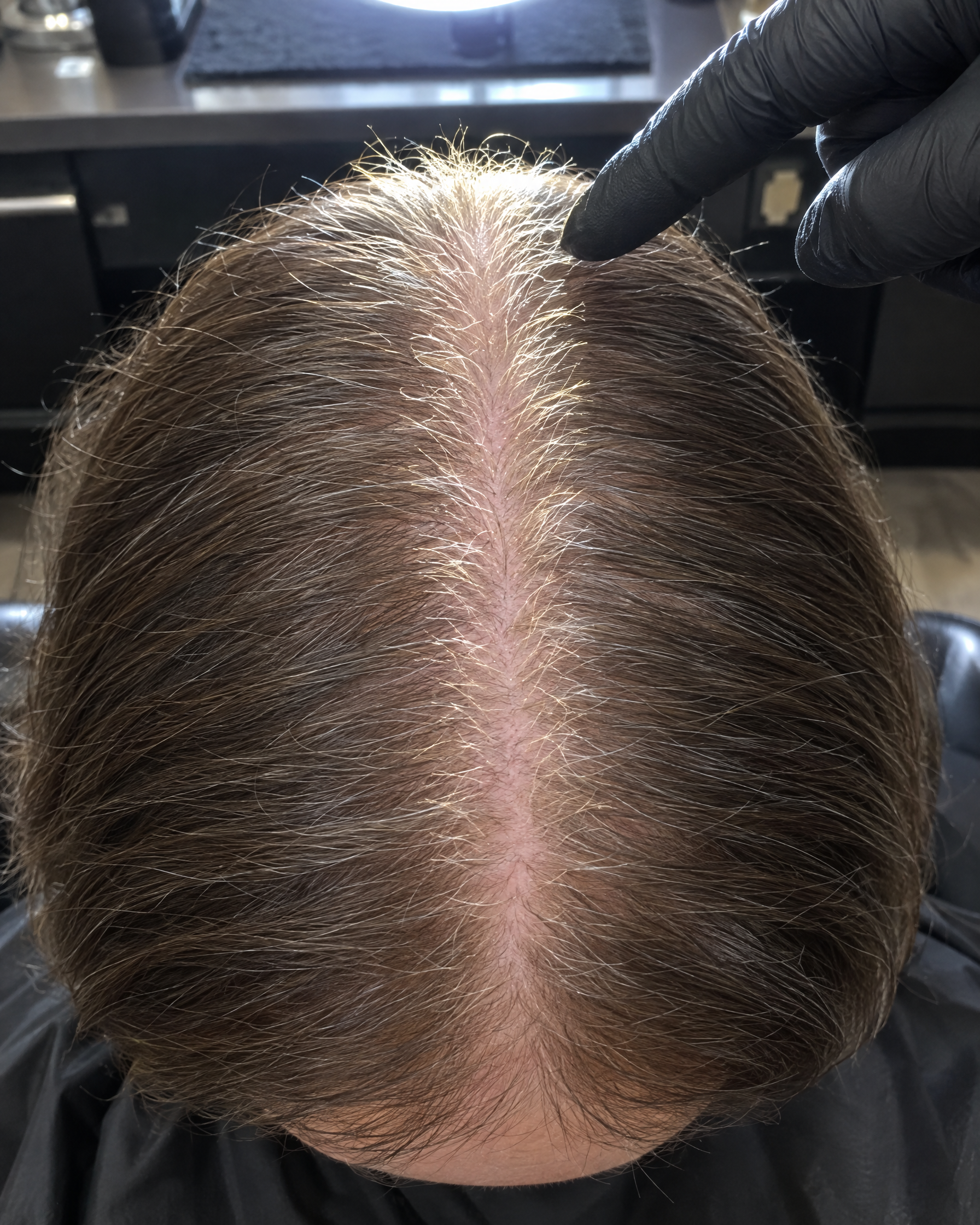 Susan Smith Facebook ad: 274 hairs in my drain at week six. I quit. I was WRONG.