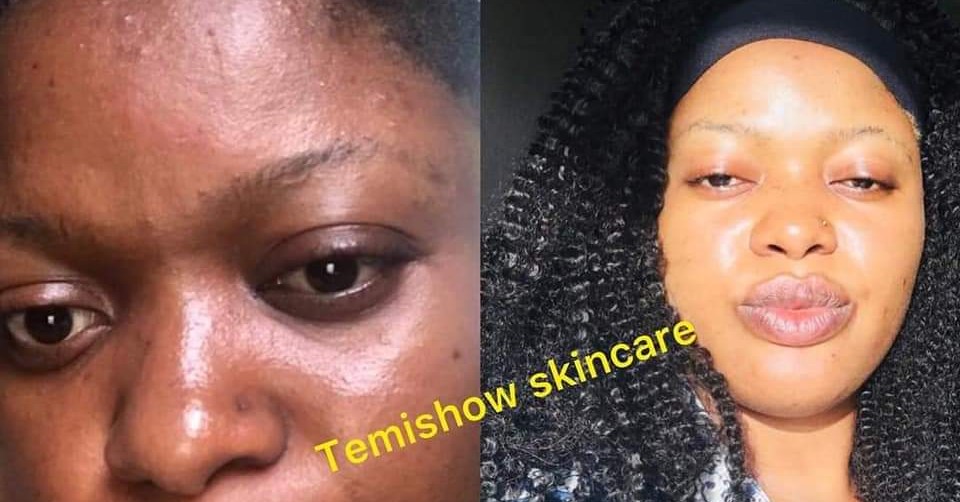 Temishow cosmetic and hair Facebook ad: we deals with cosmetic,hair, skin supplement, organic…