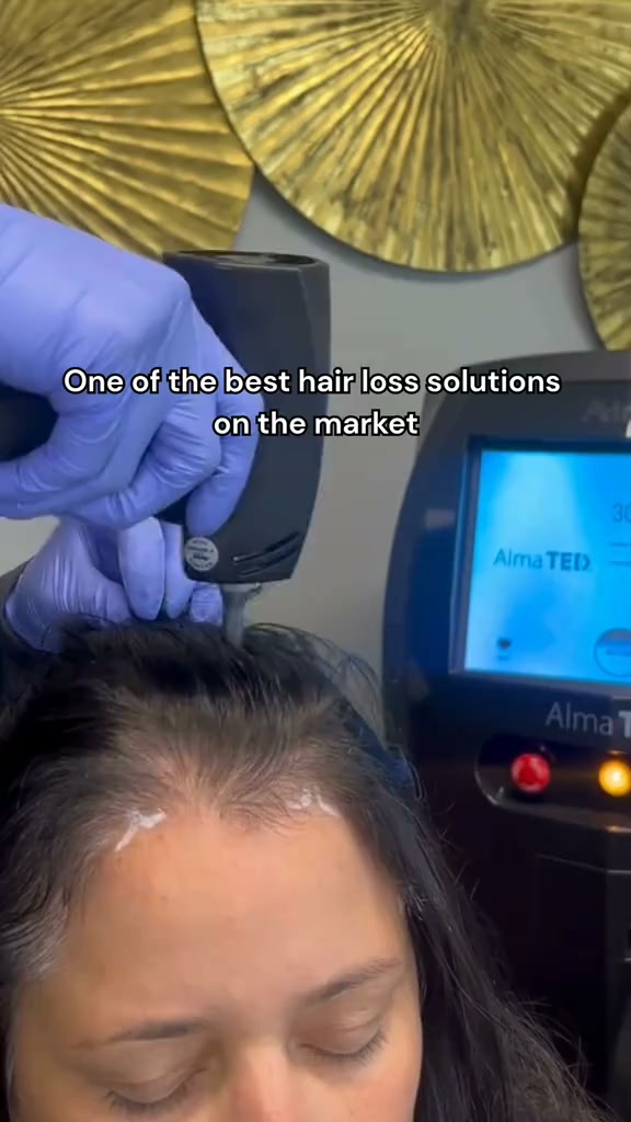Elite MD Aesthetics Facebook ad: Markham: Hair Restoration From $199/Month