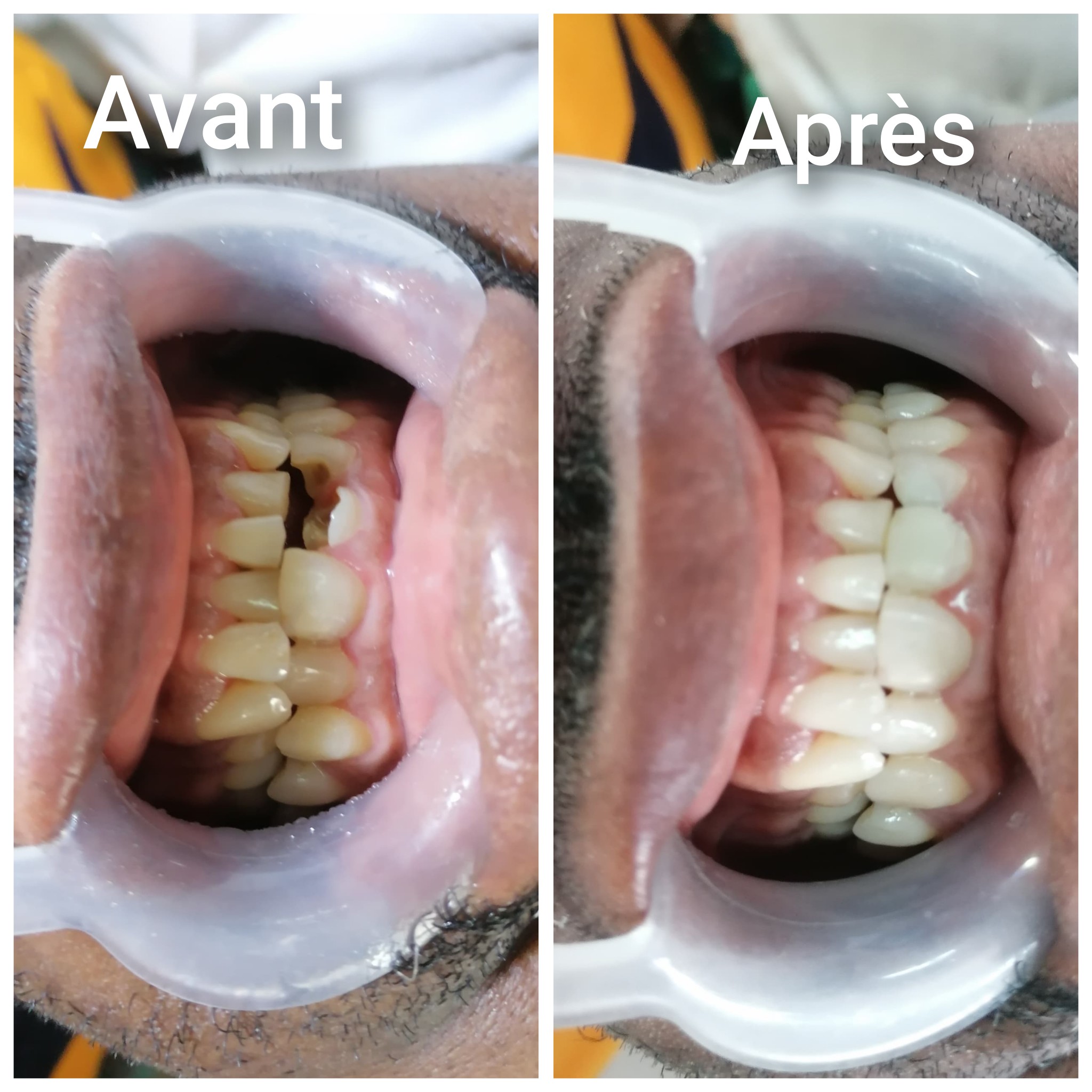 Dental Smile Facebook ad: Comme ce patient satisfait