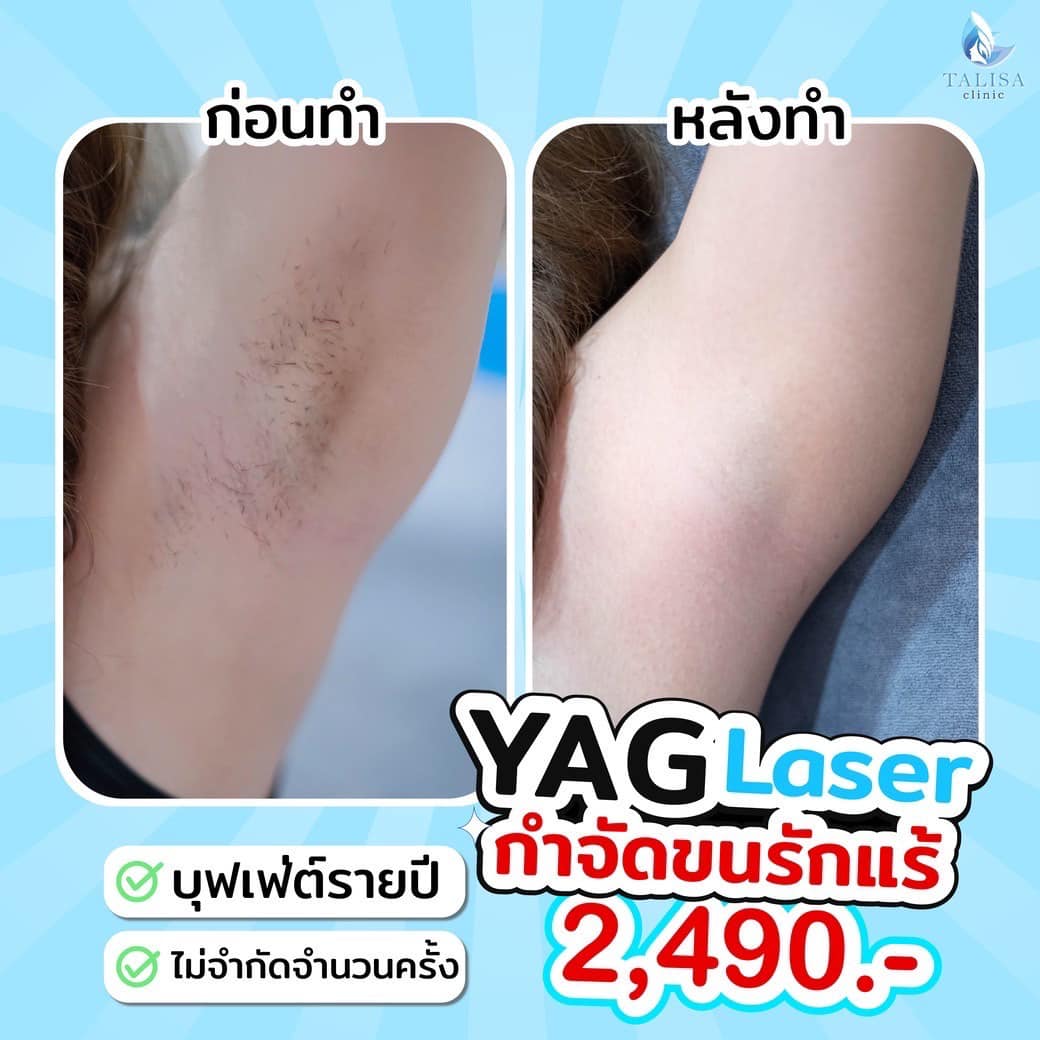 TALISA Clinic Facebook ad