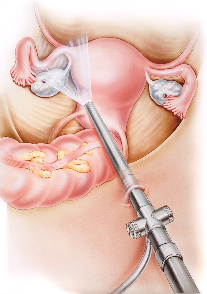 Dr. Amanda Wilson - Gastroenterologist Facebook ad: Get Rid Of Constipation