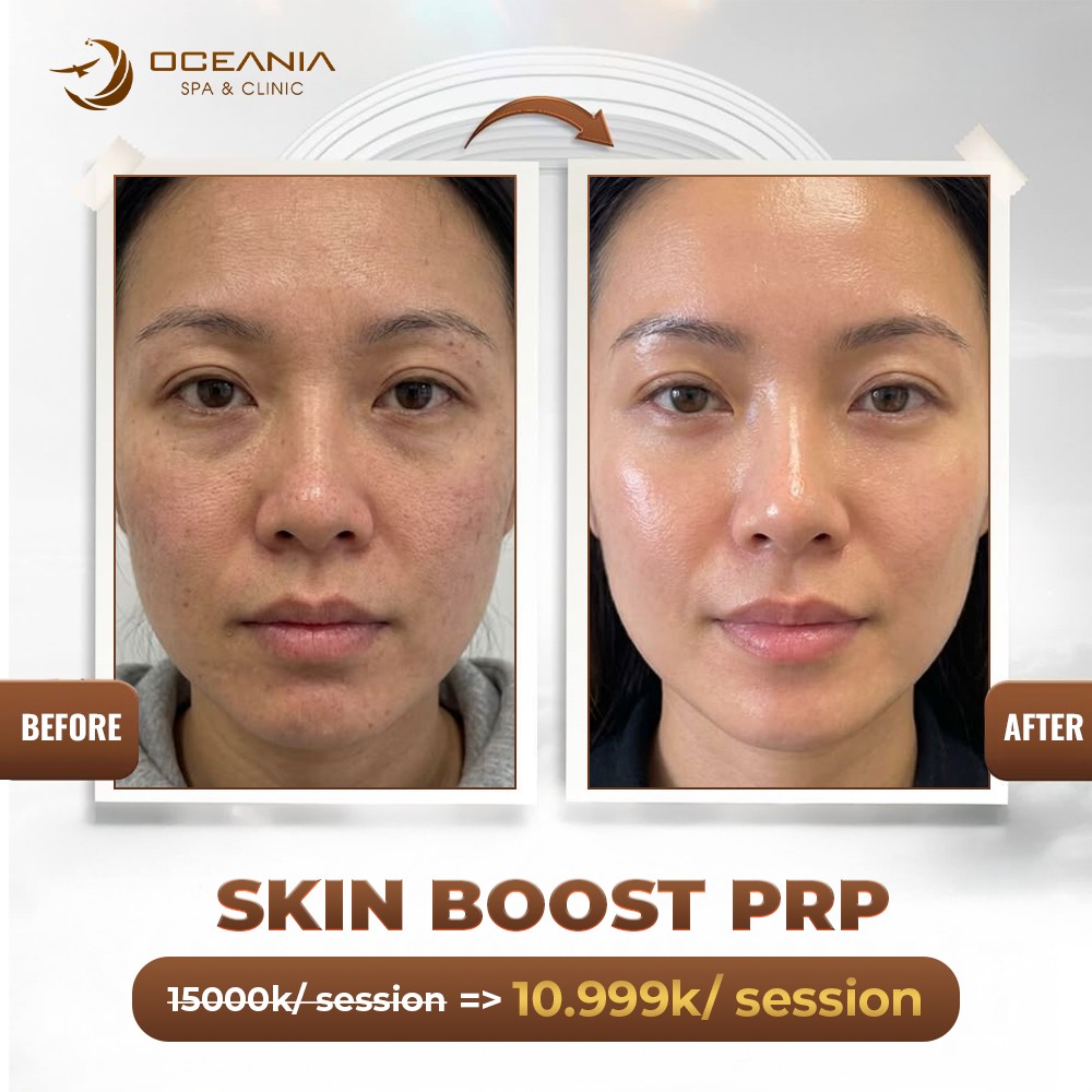 Oceania Spa & Clinic Facebook ad: REGENERATE AGELESS SKIN WITH BIO-STIM CELLULAR REVIVE PRP…