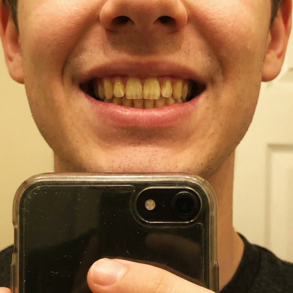 Chris Hill Facebook ad: Read this if you have yellow teeth