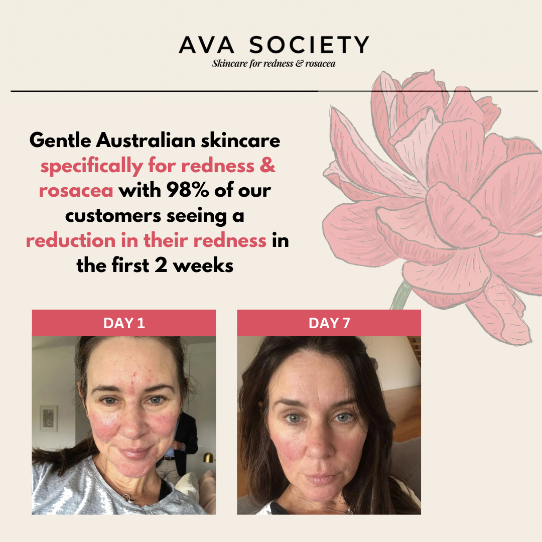 Ava Society Skincare Facebook ad