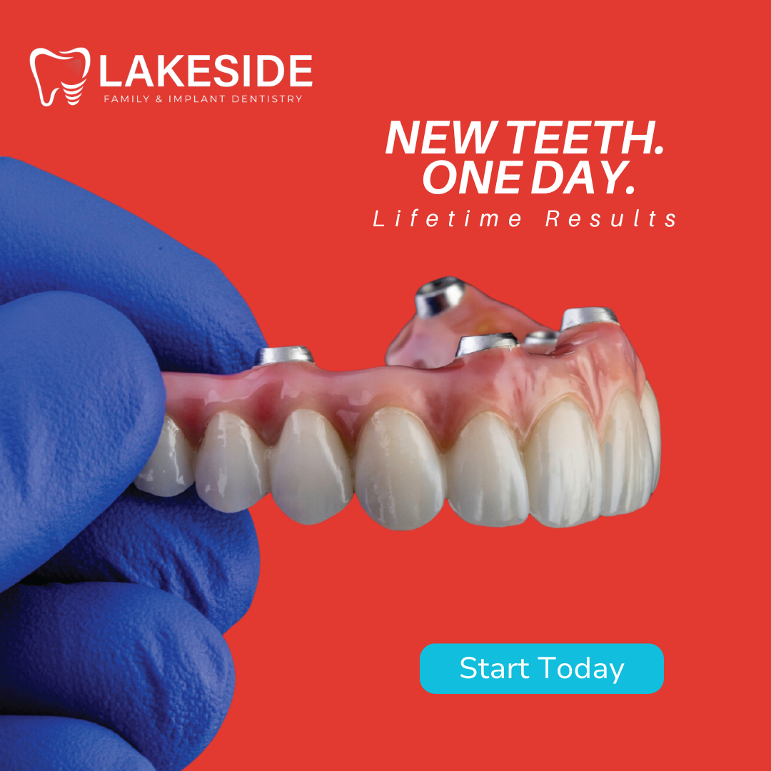 Lakeside Family & Implant Dentistry Facebook ad: Discover Immediately