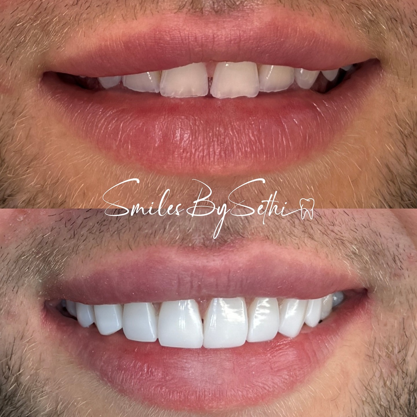 smilesbysethi Facebook ad