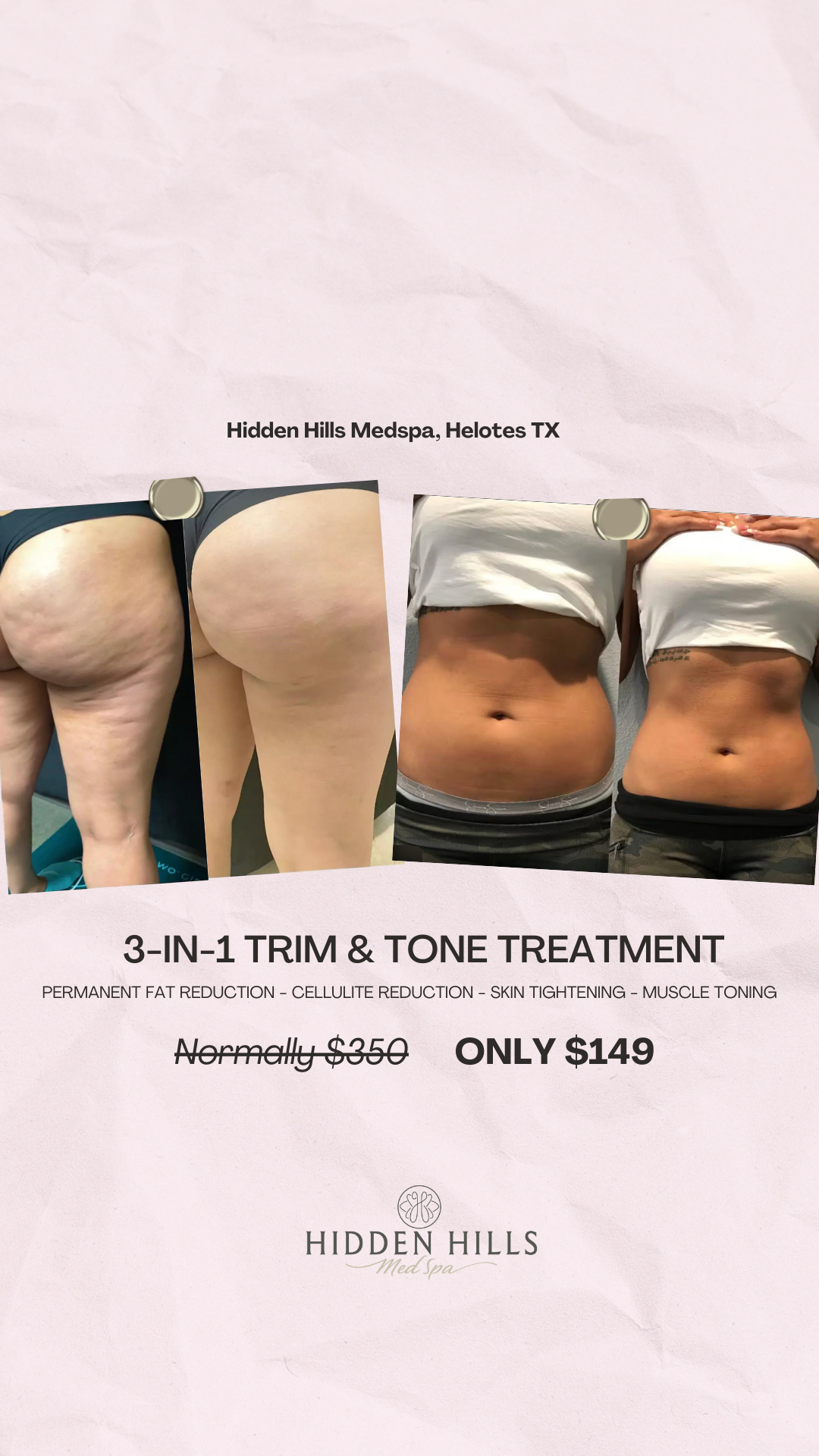 Hidden Hills Med Spa Facebook ad from Jan 11, 2026