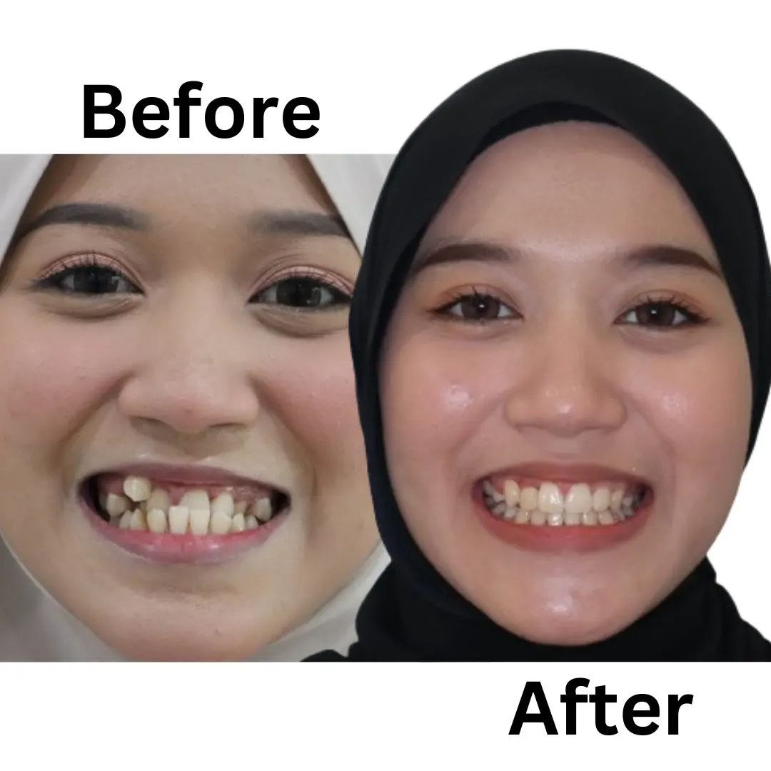 Klinik Pergigian Dr Smile Taman Equine Facebook ad