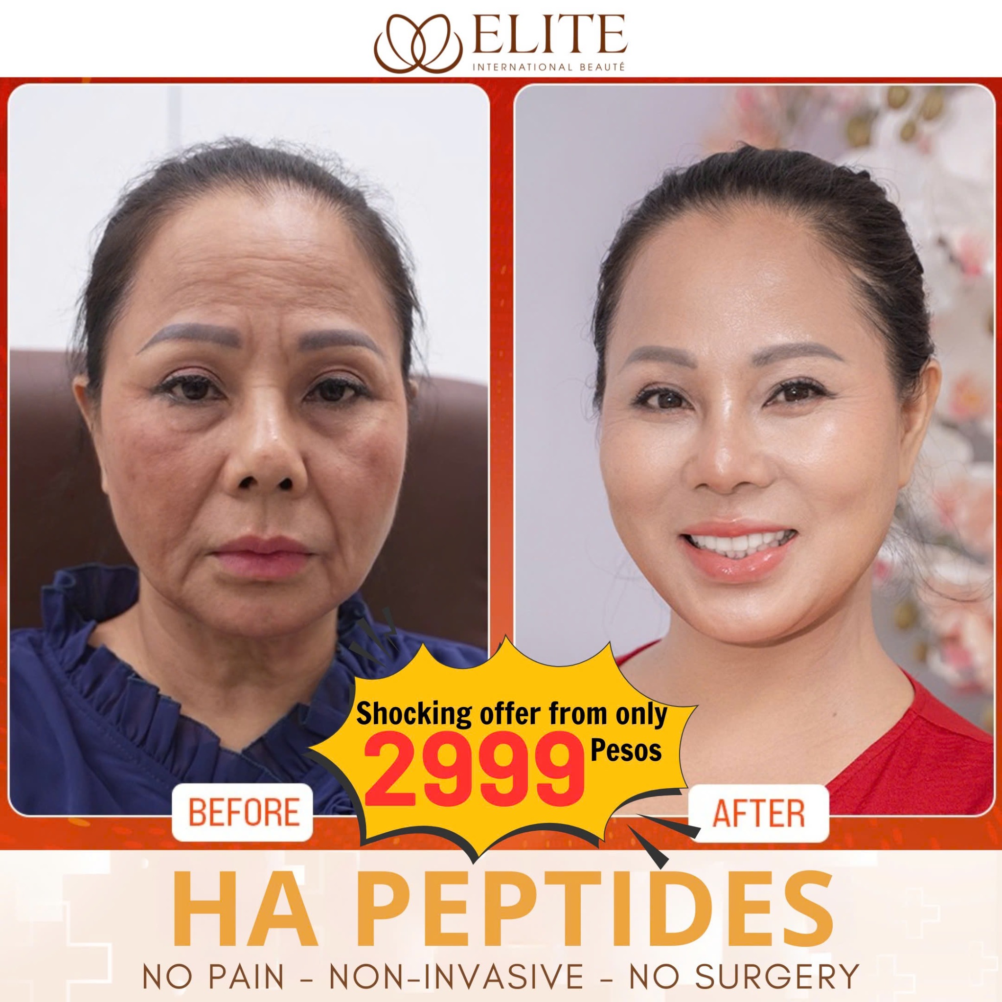 ELITE-Korean Beauty Technology Facebook ad: LOOK 10 YEARS YOUNGER FOR ONLY 2999