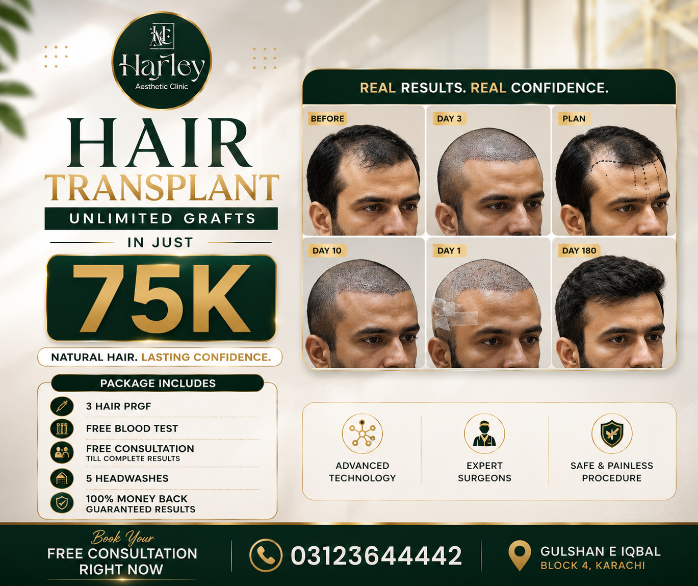 Harley Aesthetic Clinic Facebook ad: Hair Transplant Unlimited Grafts, Only Rs. 75,000