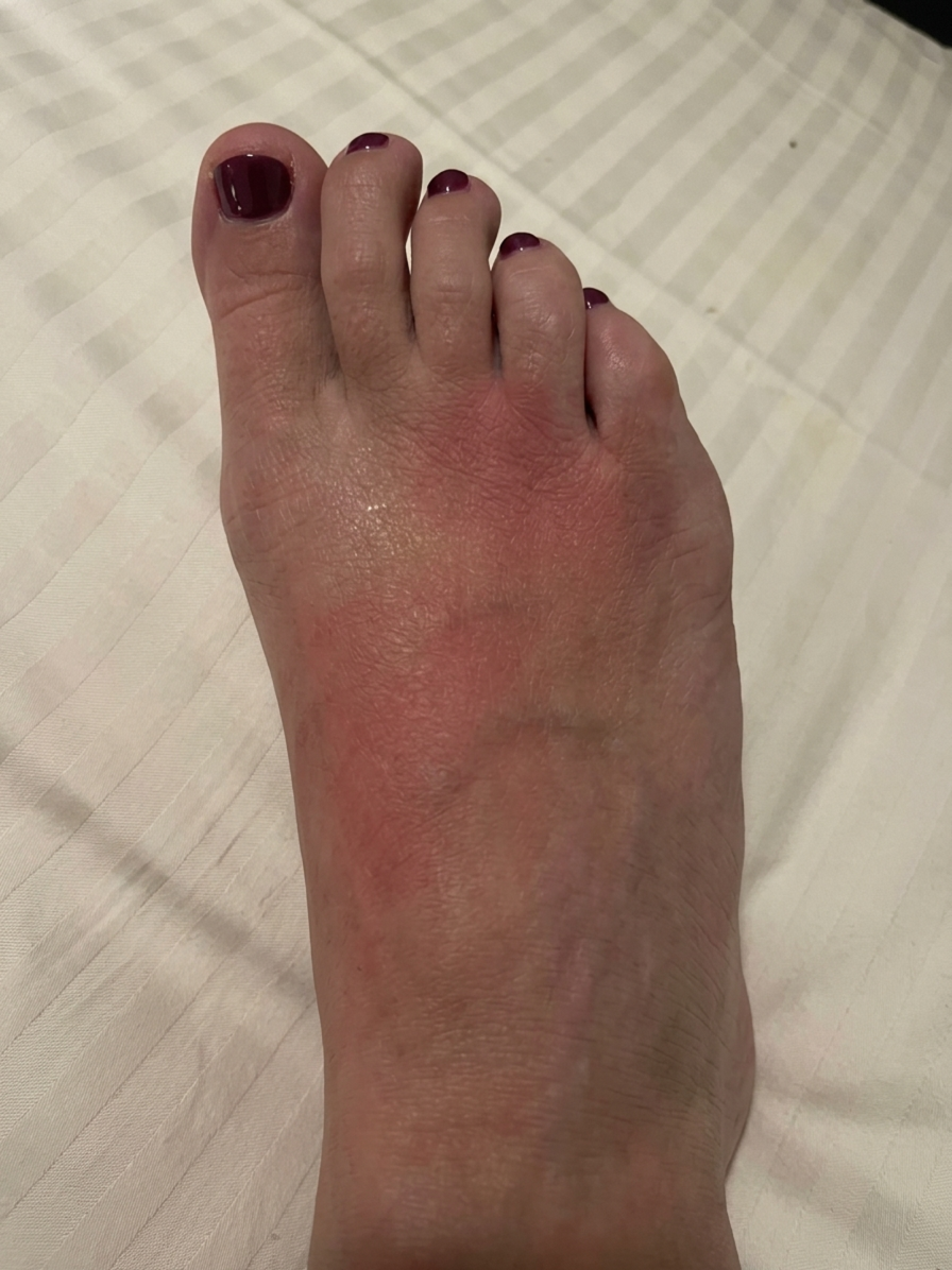 Jennifer Thompson Facebook ad: why your feet ache for days