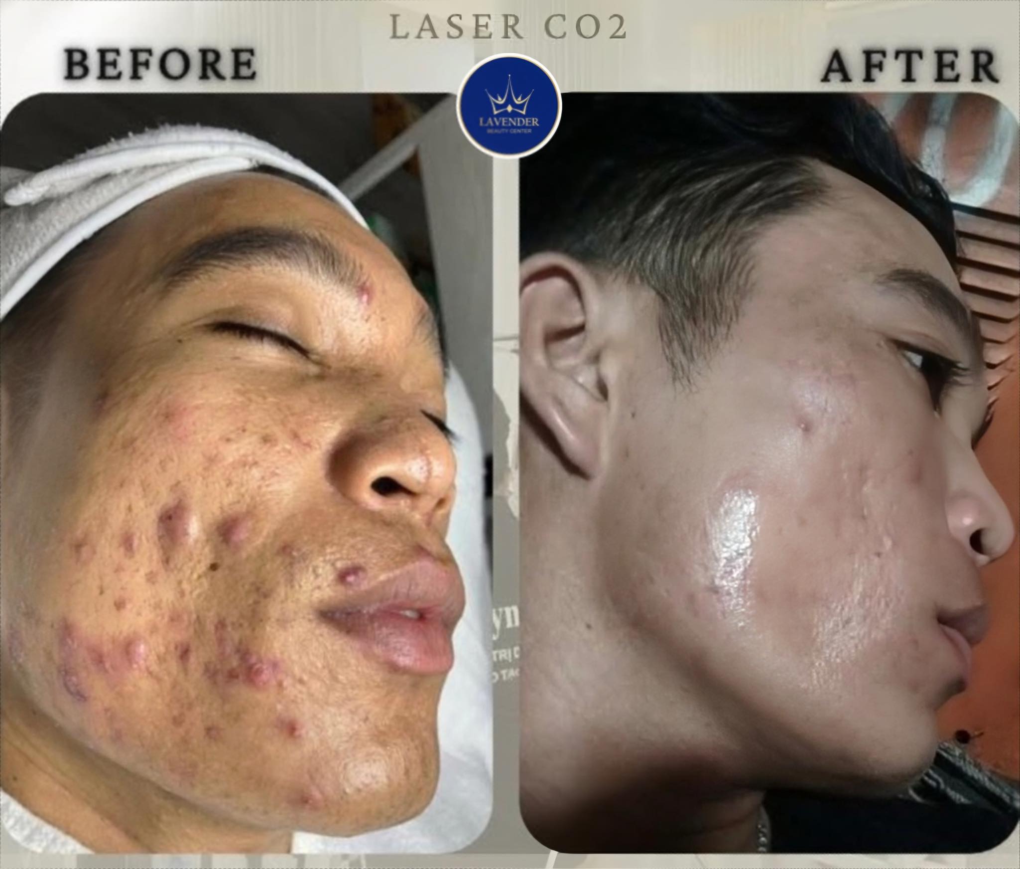 Lavender Beauty- PoiPet Facebook ad: Lavender menawarkan diskon 70% mulai hari ini hingga…